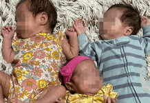 Trillizos prematuros logran vivir con atención multidisciplinaria en IMSS Aguascalientes