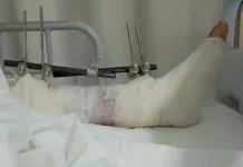 Motociclista embiste a mujer en Río Moctezuma