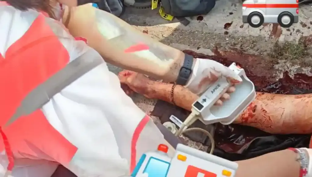 Ante este señalamiento, el agresor salió al encuentro de la víctima y le propinó al menos 12 puñaladas.
